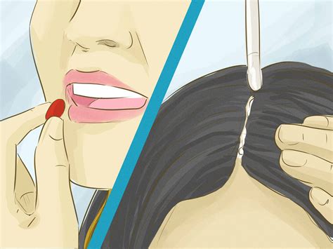 Can itchy scalp cause hair loss? Doctor-Approved Advice on How to Prevent Hair Loss - wikiHow