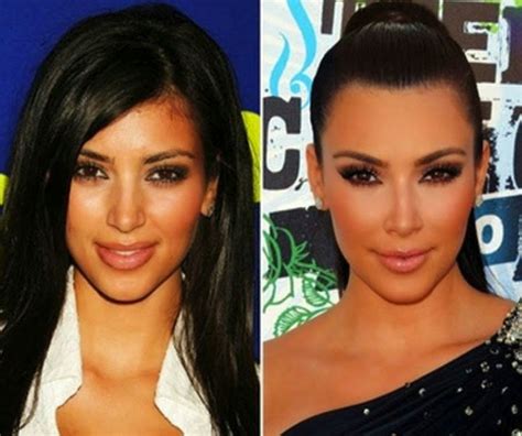 Kim Kardashian Antes Y Despues Hot Sex Picture