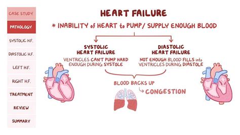 Heart Failure Pathology Review Video And Anatomy Osmosis