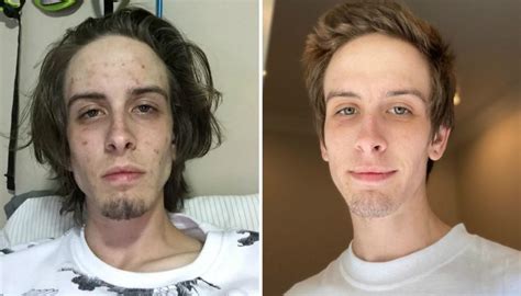 Former Drug Addict Shares Inspiring Before And After Photos To Show