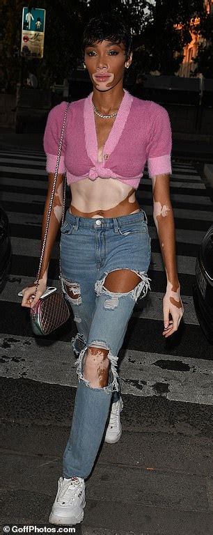 Winnie Harlow Debuts Cropped Locks And Flashes Her Washboard Abs In A