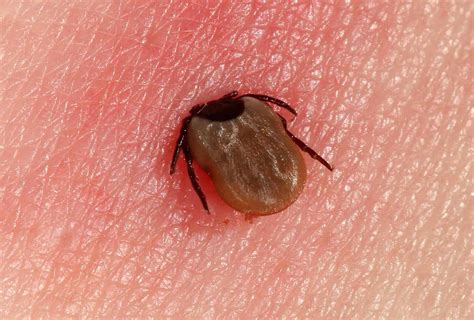 Lyme Disease Symptoms Testing And Treatment