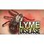 Symptoms Of Untreated Lyme Disease