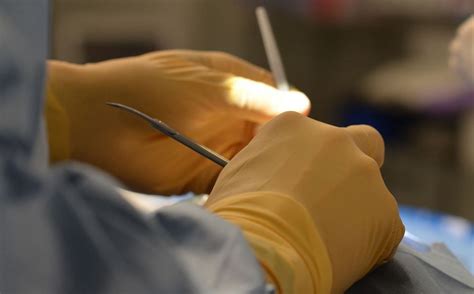 Al menos 23 muertes en los ritos de circuncisión tradicionales en
