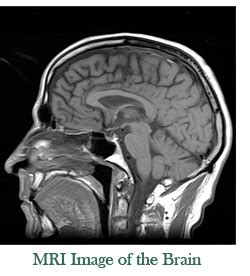 Magnetic Resonance Imaging (MRI) | The Imaging Center | MRI CT X-ray Ultrasound DEXA | Fort ...