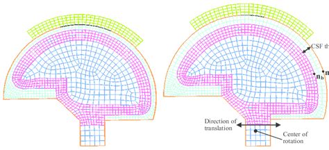 Fe Head Models A Maximum Fontanelle Size And Minimum Csf Thickness