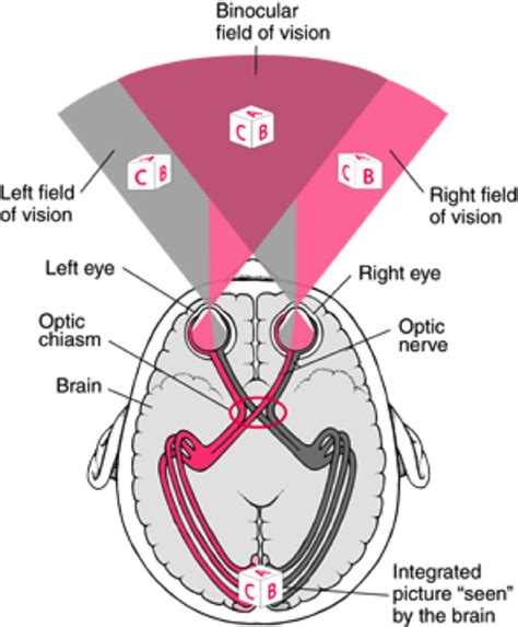 Visual Field Defects Double Vision And Optic Disc Swelling
