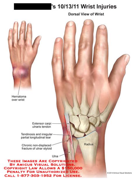 25 Radius And Ulna Diagram Wiring Database 2020