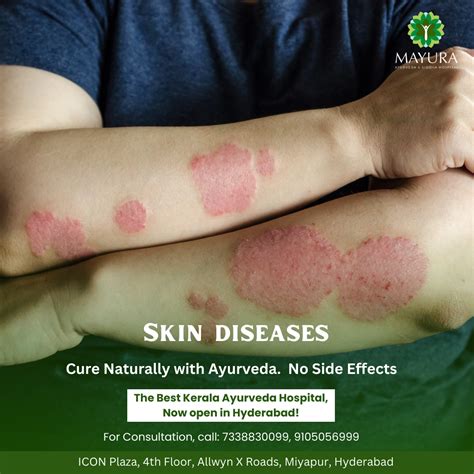 Understanding Common Skin Diseases Causes Symptoms And Treatment