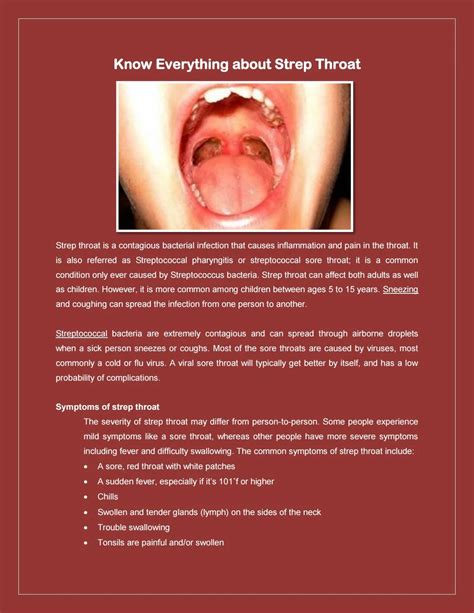 Know Everything About Strep Throat By Health Care Tips Issuu