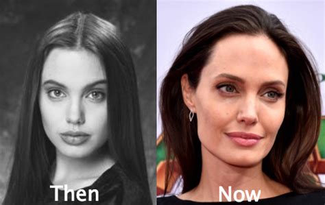 Angelina Jolie Before And After Plastic Surgery Photos