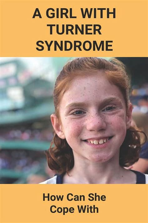 A Girl With Turner Syndrome How Can She Cope With Parsonage Turner Syndrome Radiology