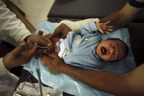 Falling Circumcision Rates In Us Raise Disease Risk And Healthcare Costs