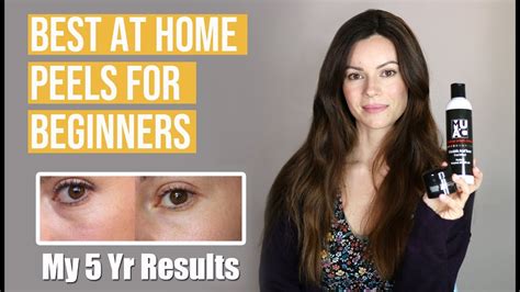 Fair skin responds well to most hyperpigmentation procedures. Best At-Home Chemical Peels & My 5 Yr. Results - YouTube