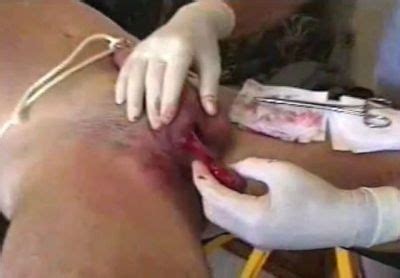 Femdom Real Castration Nude Pix Hq