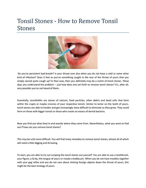 How To Remove Tonsil Stones Without Gagging By Outlook532 Issuu