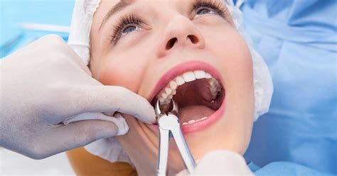 Tooth Extraction And How Its Done On Point Dental