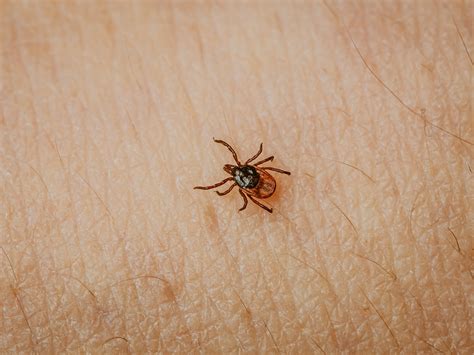 Ticks On Human Skin