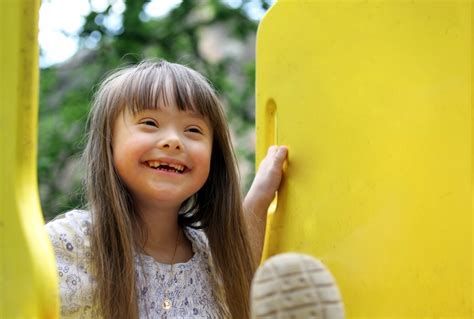 Down syndrome is a genetic disorder that results in an extra copy of chromosome 21. What is Down's syndrome? | Facts | yourgenome.org