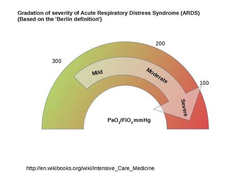 Acute Respiratory Distress Syndrome Ards Physiopedia
