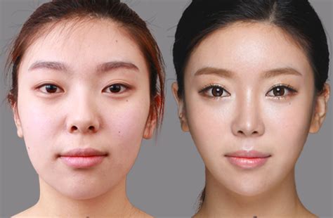 Asian Celebrities Plastic Surgery Before And After Pictures 2018 Plastic Surgery Before And After