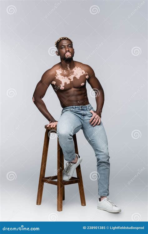 Shirtless African American Man With Vitiligo Stock Image Image Of