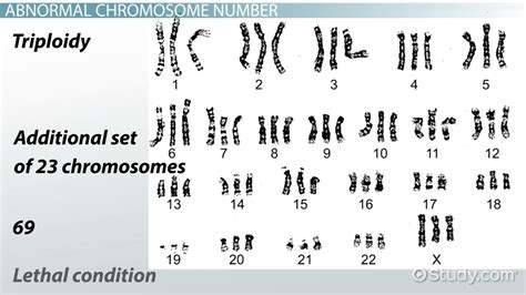 Abnormal Chromosome Number And Structure Video And Lesson Transcript