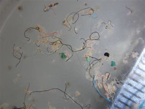 Sgi Microplastics Under Microscope Zamia Ventures