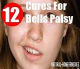Facial Muscle Exercise For Bell''s Palsy Images