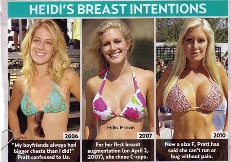 Hills Freak Heidi Montag Reportedly Wants To Undo Surgery