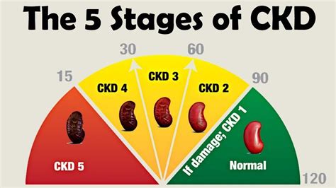 Stages Of Kidney Disease The 5 Stages Of Ckd Based On Gfr