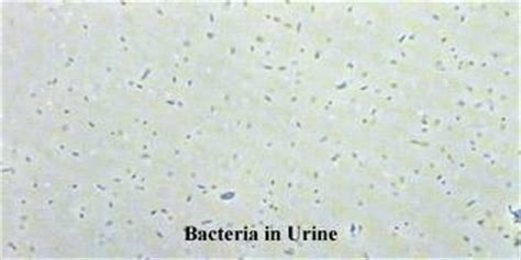 Bacteria 1 urine. How effective are antibiotics?
