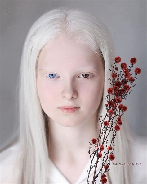 Sorprendentes Retratos De Una Niña Con Albinismo Y Heterocromía