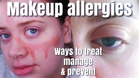 Swollen Eyelid Makeup Allergy Tutorial Pics