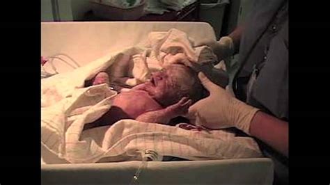 Twins Born By C Section Youtube