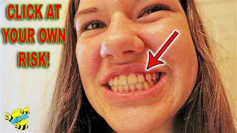 The prospect of paying for braces can be a shock. GETTING BRACES OFF! 😃 ~ FIRST TIME FLOSSING, BLOODY AND ...