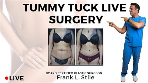 Tummy Tuck Live Surgery Youtube