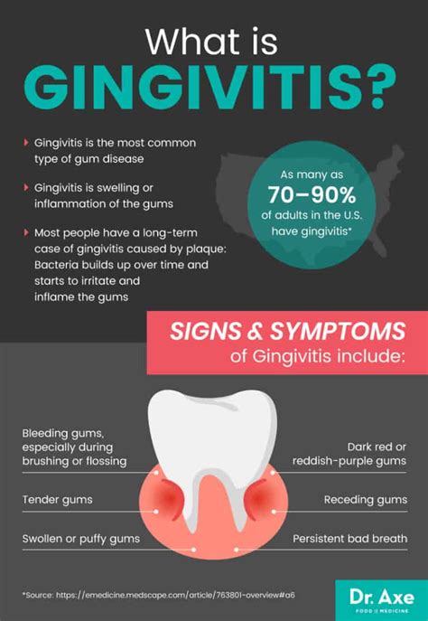 Gingivitis Symptoms And How To Get Rid Of Gum Disease Dr Axe