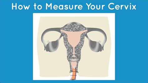 How To Measure Your Cervix Hygiene And You YouTube
