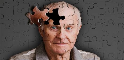 ¡10 Síntomas Que Pueden Indicar La Enfermedad De Alzheimer En Una Etapa