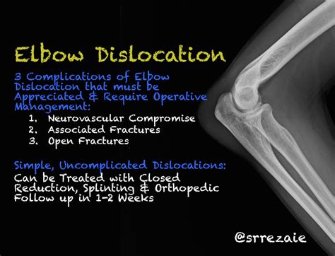 Elbow Dislocation Emergency Medicine Kenya Foundation