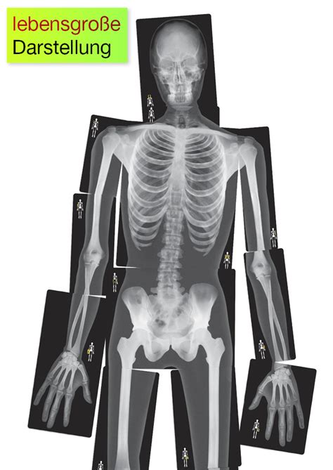 röntgenbilder mensch lebensgroß 18 tlg timetex de lehrerbedarf lehrermaterial in ihrem