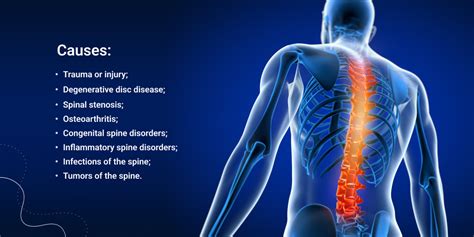 Spinal Cord Disorders Symptoms Causes And Treatment