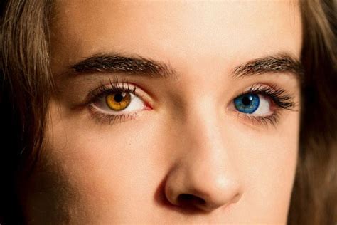 Heterochromia A Beautiful Mutation Steemit Color De Ojos Fotos De Ojos Ojos Bonitos
