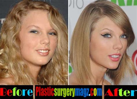 Taylor Swift Plastic Surgery Before And After Pictures Plastic Surgery Magazine
