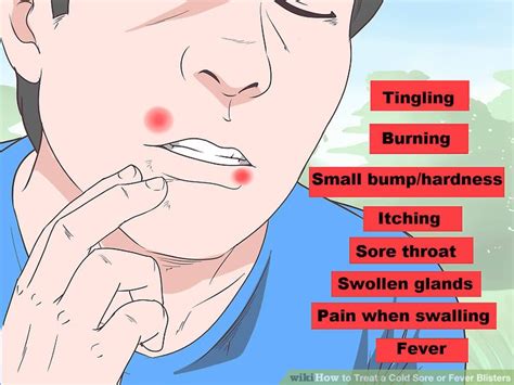 You were relieved by a course of antibiotics. Best treatment for fever blisters - ALQURUMRESORT.COM