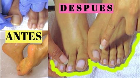 As Me Cuido Mis U As De Los Pies My Pedicure Rutine Como Limpiar Las