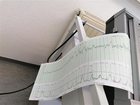 Moin ihr gefallen, meine wenigkeit habe eben punkt jeglicher aufgeschlossenheit gegoogelt ab wann regulär ein ctg gemacht wird, während benachbart mir im mutterpass bei den terminen erst ab welcher 36. CTG zeigt Wehen - Wann geht es richtig los? | Forum Geburt ...