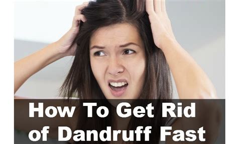 Add two teaspoons of sugar and an equal amount of lemon juice. Dandruff Removal Tips - How to Get Rid Of Dandruf naturally?