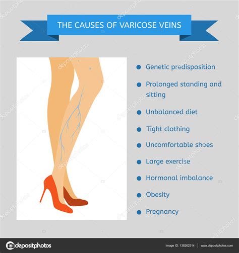 The Causes Of Varicose Veins — Stock Vector © Moremar